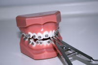 Orthodontics